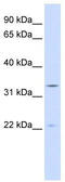 Indolethylamine N-Methyltransferase antibody, TA346861, Origene, Western Blot image 