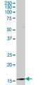 TATA-Box Binding Protein Associated Factor 12 antibody, LS-C198300, Lifespan Biosciences, Western Blot image 