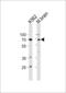 Tumor Protein P73 antibody, MBS9214718, MyBioSource, Western Blot image 