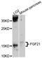 Fibroblast Growth Factor 21 antibody, abx125845, Abbexa, Western Blot image 