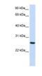 Tetratricopeptide Repeat Domain 33 antibody, NBP1-55426, Novus Biologicals, Western Blot image 