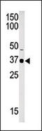 SET Domain Containing 7, Histone Lysine Methyltransferase antibody, 56-134, ProSci, Western Blot image 