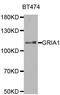 Glutamate Ionotropic Receptor AMPA Type Subunit 1 antibody, MBS127263, MyBioSource, Western Blot image 