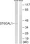 ST6 Beta-Galactoside Alpha-2,6-Sialyltransferase 1 antibody, abx014375, Abbexa, Western Blot image 