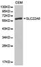 Solute Carrier Family 22 Member 6 antibody, LS-C192950, Lifespan Biosciences, Western Blot image 