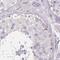 Cyclase Associated Actin Cytoskeleton Regulatory Protein 2 antibody, PA5-62932, Invitrogen Antibodies, Immunohistochemistry frozen image 