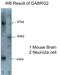 Gamma-Aminobutyric Acid Type A Receptor Gamma2 Subunit antibody, 14104-1-AP, Proteintech Group, Western Blot image 