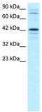 SRY-Box 18 antibody, TA331859, Origene, Western Blot image 