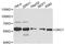 Dyskerin Pseudouridine Synthase 1 antibody, LS-C747985, Lifespan Biosciences, Western Blot image 