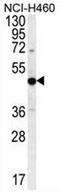 PRAME Family Member 8 antibody, AP53436PU-N, Origene, Western Blot image 