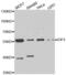 Eukaryotic Translation Initiation Factor 5 antibody, abx005049, Abbexa, Western Blot image 