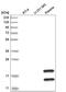 Transmembrane Protein 241 antibody, NBP2-56668, Novus Biologicals, Western Blot image 