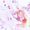 Eukaryotic Translation Initiation Factor 2 Alpha Kinase 2 antibody, LS-C354070, Lifespan Biosciences, Immunohistochemistry paraffin image 