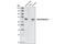 Neurofilament Light antibody, 2837P, Cell Signaling Technology, Western Blot image 