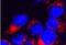 Transient Receptor Potential Cation Channel Subfamily M Member 7 antibody, NBP1-20224, Novus Biologicals, Immunocytochemistry image 