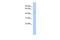 RasGEF Domain Family Member 1C antibody, GTX45210, GeneTex, Western Blot image 