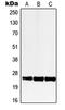 Lecithin Retinol Acyltransferase antibody, GTX55182, GeneTex, Western Blot image 