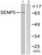 SUMO Specific Peptidase 5 antibody, abx013229, Abbexa, Western Blot image 