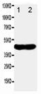 N-Myc Downstream Regulated 1 antibody, LS-C312579, Lifespan Biosciences, Western Blot image 