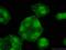 Protein Phosphatase 1 Catalytic Subunit Beta antibody, 55136-1-AP, Proteintech Group, Immunofluorescence image 