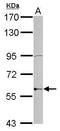 Zinc Finger Protein 596 antibody, GTX117309, GeneTex, Western Blot image 