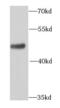 Adaptor Related Protein Complex 1 Subunit Mu 2 antibody, FNab00460, FineTest, Western Blot image 