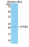 Serpin Family G Member 1 antibody, LS-C299929, Lifespan Biosciences, Western Blot image 
