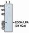 Lysophosphatidic acid receptor 2 antibody, PA1-12694, Invitrogen Antibodies, Western Blot image 