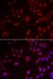 Preferentially Expressed Antigen In Melanoma antibody, orb373396, Biorbyt, Immunofluorescence image 