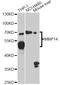 Matrix Metallopeptidase 14 antibody, A2549, ABclonal Technology, Western Blot image 