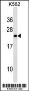 NOP16 Nucleolar Protein antibody, 60-199, ProSci, Western Blot image 