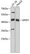 Dipeptidase 1 antibody, 22-103, ProSci, Western Blot image 
