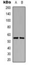 Serine/Threonine Kinase 32C antibody, orb319034, Biorbyt, Western Blot image 