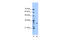 Methyltransferase Like 1 antibody, ARP48665_T100, Aviva Systems Biology, Western Blot image 