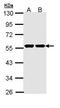 Glucokinase antibody, GTX111517, GeneTex, Western Blot image 