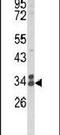 Clathrin Light Chain A antibody, PA5-26026, Invitrogen Antibodies, Western Blot image 