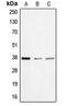BCL2 Interacting Protein 2 antibody, LS-C351872, Lifespan Biosciences, Western Blot image 