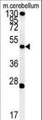 Ectonucleotide Pyrophosphatase/Phosphodiesterase 6 antibody, LS-C167767, Lifespan Biosciences, Western Blot image 