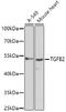 Transforming growth factor beta-2 antibody, GTX32920, GeneTex, Western Blot image 