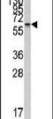 Cytochrome P450 Family 26 Subfamily A Member 1 antibody, PA5-12339, Invitrogen Antibodies, Western Blot image 