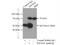 SMAD Family Member 4 antibody, 10231-1-AP, Proteintech Group, Immunoprecipitation image 