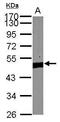 Pygopus Family PHD Finger 2 antibody, PA5-31553, Invitrogen Antibodies, Western Blot image 