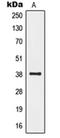 G Protein-Coupled Receptor 20 antibody, orb213998, Biorbyt, Western Blot image 