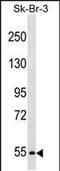 Proprotein Convertase Subtilisin/Kexin Type 4 antibody, PA5-48804, Invitrogen Antibodies, Western Blot image 