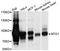 Mitochondrial TRNA Translation Optimization 1 antibody, STJ111580, St John