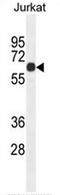 Coiled-Coil Domain Containing 8 antibody, AP50791PU-N, Origene, Western Blot image 