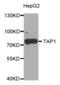 Transporter 1, ATP Binding Cassette Subfamily B Member antibody, abx004748, Abbexa, Western Blot image 