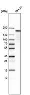 TOP2A antibody, NBP1-86928, Novus Biologicals, Western Blot image 