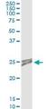 Opa Interacting Protein 5 antibody, H00011339-M01, Novus Biologicals, Immunoprecipitation image 