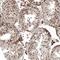 Potassium Channel Tetramerization Domain Containing 13 antibody, PA5-60403, Invitrogen Antibodies, Immunohistochemistry paraffin image 